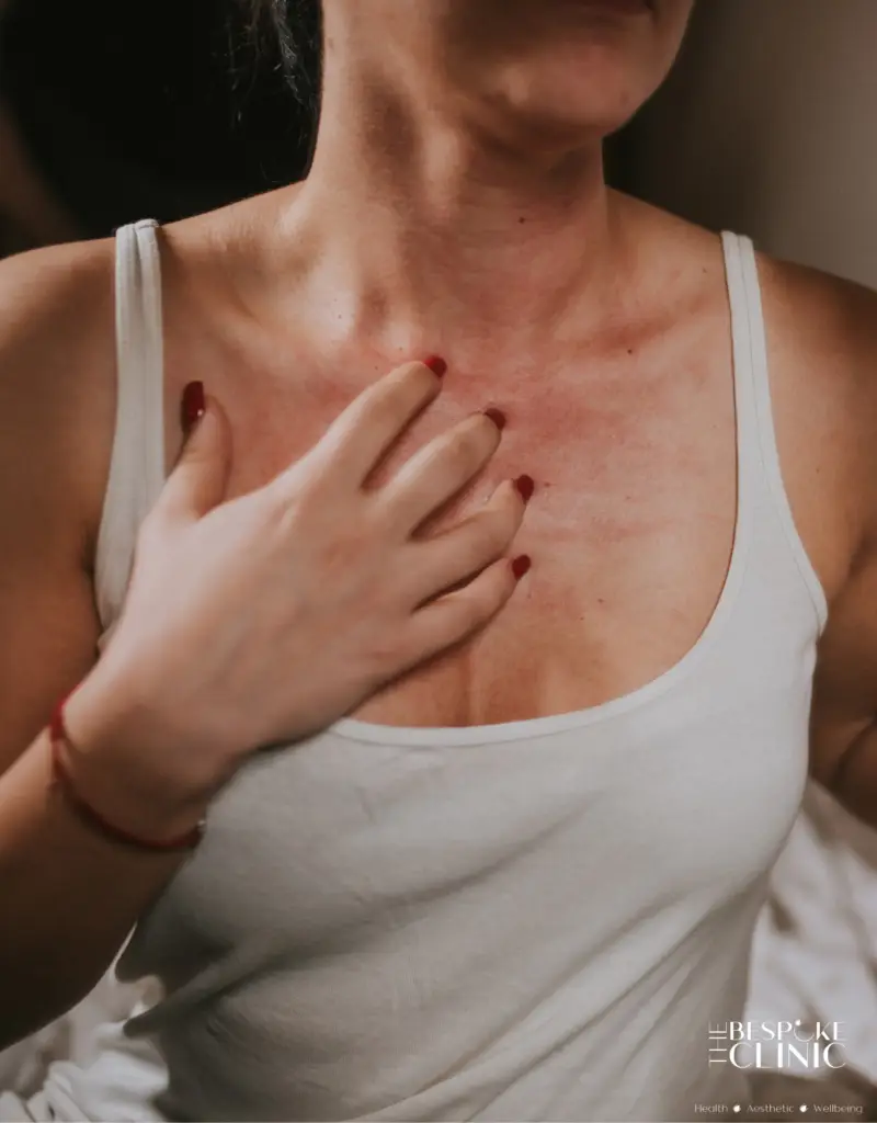 Close-up of a person’s chest and neck showing red irritated skin with a hand resting on the chest, wearing a white tank top.